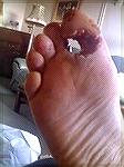 45 acp to the foot